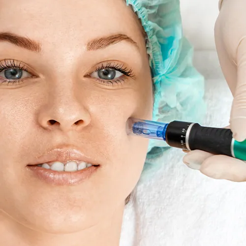 Microneedling
